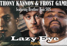 Anthony Kannon & Frost Gamble Presentan El Video Oficial De: "Lazy Eye" + El Remix Ft. Brother Tom SOS